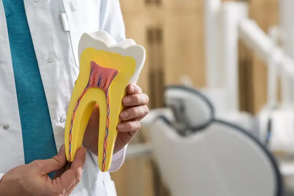 dental-pro-shows-tooth-model-to-educate-patients-about-root-canal-treatment